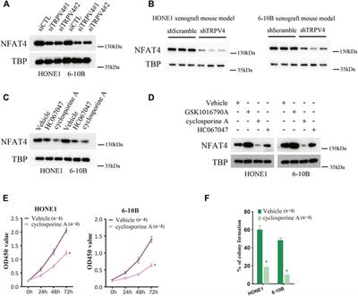 Transient receptor potential vanilloid type 4 (TRPV4) promotes tumorigenesis via NFAT4 activation in nasopharyngeal carcinoma